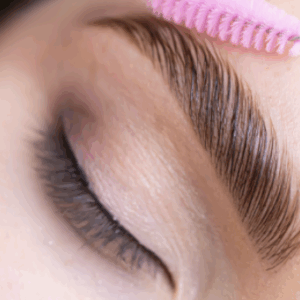 Browlift